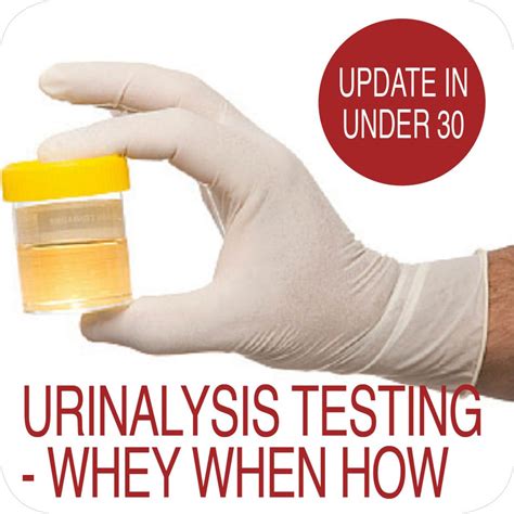 Thus, even though 120 ml of plasma filtrate entered the nephrons per minute, only the amount of urea contained in 75 ml of filtrate is excreted. . What is the substitute marker for urea in online clearance testing